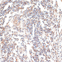 Immunohistochemistry of paraffin-embedded Human tonsil using KATNA1 Polyclonal Antibody at dilution of 1:100 (40x lens) .