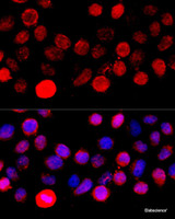 Immunofluorescence analysis of HeLa cells using BAZ1A Polyclonal Antibody at dilution of 1:100 (40x lens) . Blue: DAPI for nuclear staining.