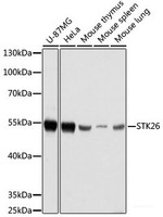 Western blot analysis of extracts of various cell lines using STK26 Polyclonal Antibody at dilution of 1:1000.