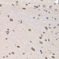 Immunohistochemistry of paraffin-embedded Rat brain using PTHLH Polyclonal Antibody at dilution of 1:200 (40x lens) .