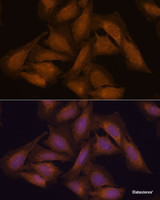 Immunofluorescence analysis of U-2 OS cells using SEPT3 Polyclonal Antibody at dilution of 1:100. Blue: DAPI for nuclear staining.