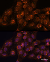 Immunofluorescence analysis of C6 cells using ACBD3 Polyclonal Antibody at dilution of 1:100. Blue: DAPI for nuclear staining.