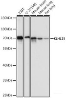 Western blot analysis of extracts of various cell lines using KLHL15 Polyclonal Antibody at dilution of 1:1000.