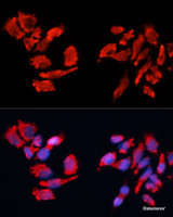 Immunofluorescence analysis of HeLa cells using CA9 Polyclonal Antibody at dilution of 1:100. Blue: DAPI for nuclear staining.