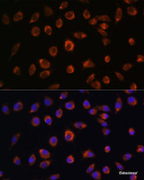 Immunofluorescence analysis of L929 cells using ARHGAP11B Polyclonal Antibody at dilution of 1:100. Blue: DAPI for nuclear staining.