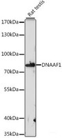 Western blot analysis of extracts of Rat testis using DNAAF1 Polyclonal Antibody at dilution of 1:1000.