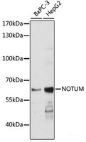 Western blot analysis of extracts of various cell lines using NOTUM Polyclonal Antibody at dilution of 1:1000.
