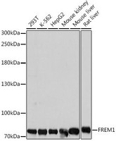 Western blot analysis of extracts of various cell lines using FREM1 Polyclonal Antibody at dilution of 1:1000.