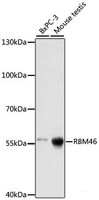 Western blot analysis of extracts of various cell lines using RBM46 Polyclonal Antibody at dilution of 1:1000.