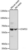 Western blot analysis of extracts of various cell lines using CFAP53 Polyclonal Antibody at dilution of 1:1000.