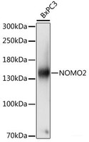 Western blot analysis of extracts of BxPC3 cells using NOMO2 Polyclonal Antibody at dilution of 1:1000.