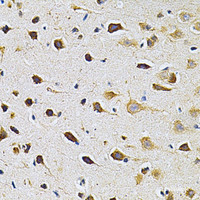 Immunohistochemistry of paraffin-embedded Rat brain using ADRBK1 Polyclonal Antibody at dilution of 1:200 (40x lens) .