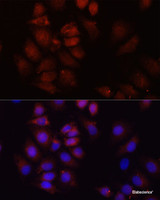 Immunofluorescence analysis of HeLa cells using HRNR Polyclonal Antibody at dilution of 1:100 (40x lens) . Blue: DAPI for nuclear staining.