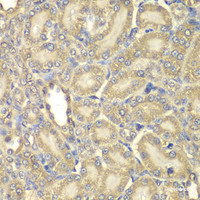 Immunohistochemistry of paraffin-embedded Rat kidney using Myelin Basic protein Polyclonal Antibody at dilution of 1:200 (40x lens) .