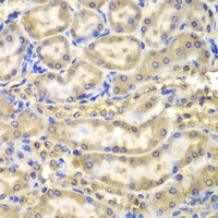 Immunohistochemistry of paraffin-embedded Mouse kidney using Myelin Basic protein Polyclonal Antibody at dilution of 1:200 (40x lens) .