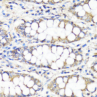 Immunohistochemistry of paraffin-embedded Human colon using TGFB1 Polyclonal Antibody at dilution of 1:100 (40x lens) .