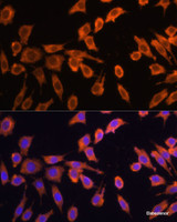 Immunofluorescence analysis of L929 cells using DRP1 Polyclonal Antibody at dilution of 1:100 (40x lens) . Blue: DAPI for nuclear staining.