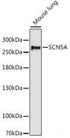 Western blot analysis of extracts of Mouse lung using SCN5A Polyclonal Antibody at dilution of 1:1000.