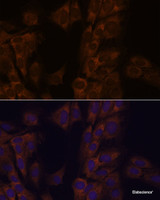 Immunofluorescence analysis of C6 cells using ATXN2 Polyclonal Antibody at dilution of 1:100. Blue: DAPI for nuclear staining.