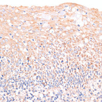 Immunohistochemistry of paraffin-embedded Human tonsil using EIF4EBP1 Polyclonal Antibody at dilution of 1:100 (40x lens) .