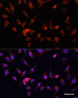 Immunofluorescence analysis of C6 cells using EIF4EBP1 Polyclonal Antibody at dilution of 1:100 (40x lens) . Blue: DAPI for nuclear staining.