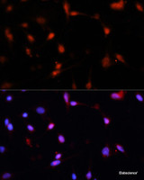 Immunofluorescence analysis of C6 cells using ESR1 Polyclonal Antibody at dilution of 1:100. Blue: DAPI for nuclear staining.