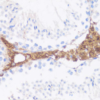 Immunohistochemistry of paraffin-embedded Mouse leydig cells using VTN Polyclonal Antibody at dilution of 1:100 (40x lens) .