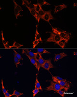 Immunofluorescence analysis of NIH-3T3 cells using ERK1 / ERK2 Polyclonal Antibody at dilution of 1:100 (40x lens) . Blue: DAPI for nuclear staining.