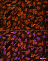 Immunofluorescence analysis of C6 cells using ERK1 / ERK2 Polyclonal Antibody at dilution of 1:100. Blue: DAPI for nuclear staining.