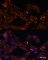 Immunofluorescence analysis of C6 cells using NRP1 Polyclonal Antibody at dilution of 1:100. Blue: DAPI for nuclear staining.