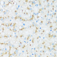 Immunohistochemistry of paraffin-embedded Human liver using APOD Polyclonal Antibody at dilution of 1:100 (40x lens) .