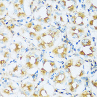 Immunohistochemistry of paraffin-embedded Human stomach using APOD Polyclonal Antibody at dilution of 1:100 (40x lens) .
