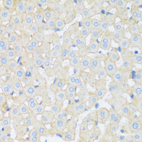 Immunohistochemistry of paraffin-embedded Rat liver using ASGR1 Polyclonal Antibody at dilution of 1:100 (40x lens) .