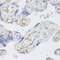 Immunohistochemistry of paraffin-embedded Human placenta using BMPR2 Polyclonal Antibody at dilution of 1:100 (40x lens) .