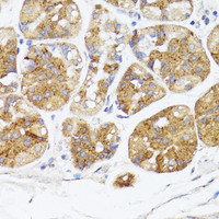 Immunohistochemistry of paraffin-embedded Human stomach using BMPR2 Polyclonal Antibody at dilution of 1:100 (40x lens) .