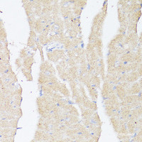 Immunohistochemistry of paraffin-embedded Mouse heart using BMPR2 Polyclonal Antibody at dilution of 1:100 (40x lens) .