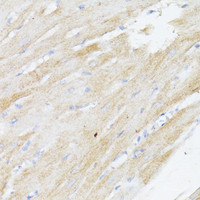 Immunohistochemistry of paraffin-embedded Rat heart using BMPR2 Polyclonal Antibody at dilution of 1:100 (40x lens) .