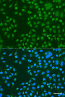 Immunofluorescence analysis of U2OS cells using KAT5 Polyclonal Antibody at dilution of 1:100. Blue: DAPI for nuclear staining.