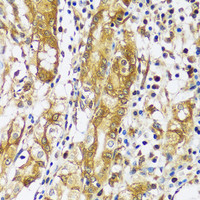 Immunohistochemistry of paraffin-embedded Human stomach using CAST Polyclonal Antibody at dilution of 1:100 (40x lens) .