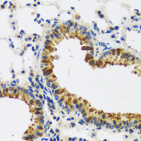 Immunohistochemistry of paraffin-embedded Mouse lung using CAST Polyclonal Antibody at dilution of 1:100 (40x lens) .