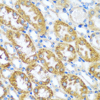 Immunohistochemistry of paraffin-embedded Mouse kidney using CAST Polyclonal Antibody at dilution of 1:100 (40x lens) .