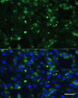 Immunofluorescence analysis of C6 cells using ENO1 Polyclonal Antibody at dilution of 1:100. Blue: DAPI for nuclear staining.