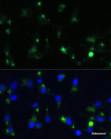 Immunofluorescence analysis of NIH-3T3 cells using ENO1 Polyclonal Antibody at dilution of 1:100. Blue: DAPI for nuclear staining.