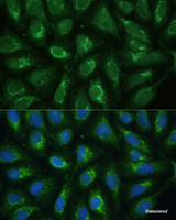 Immunofluorescence analysis of U-2 OS cells using FXN Polyclonal Antibody at dilution of 1:100. Blue: DAPI for nuclear staining.
