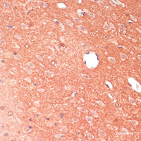 Immunohistochemistry of paraffin-embedded Mouse brain using GAP43 Polyclonal Antibody at dilution of 1:100 (40x lens) .