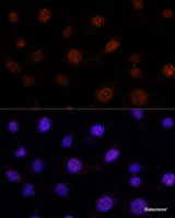 Immunofluorescence analysis of L-929 cells using GLI2 Polyclonal Antibody at dilution of 1:100. Blue: DAPI for nuclear staining.