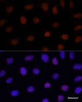 Immunofluorescence analysis of U-2 OS cells using GLI2 Polyclonal Antibody at dilution of 1:100. Blue: DAPI for nuclear staining.