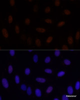 Immunofluorescence analysis of U-2 OS cells using GLI2 Polyclonal Antibody at dilution of 1:100. Blue: DAPI for nuclear staining.