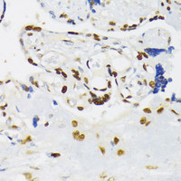 Immunohistochemistry of paraffin-embedded Human placenta using HIF1A Polyclonal Antibody at dilution of 1:200 (40x lens) .