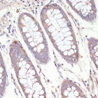 Immunohistochemistry of paraffin-embedded Human colon using HMGCR Polyclonal Antibody at dilution of 1:200 (40x lens) .